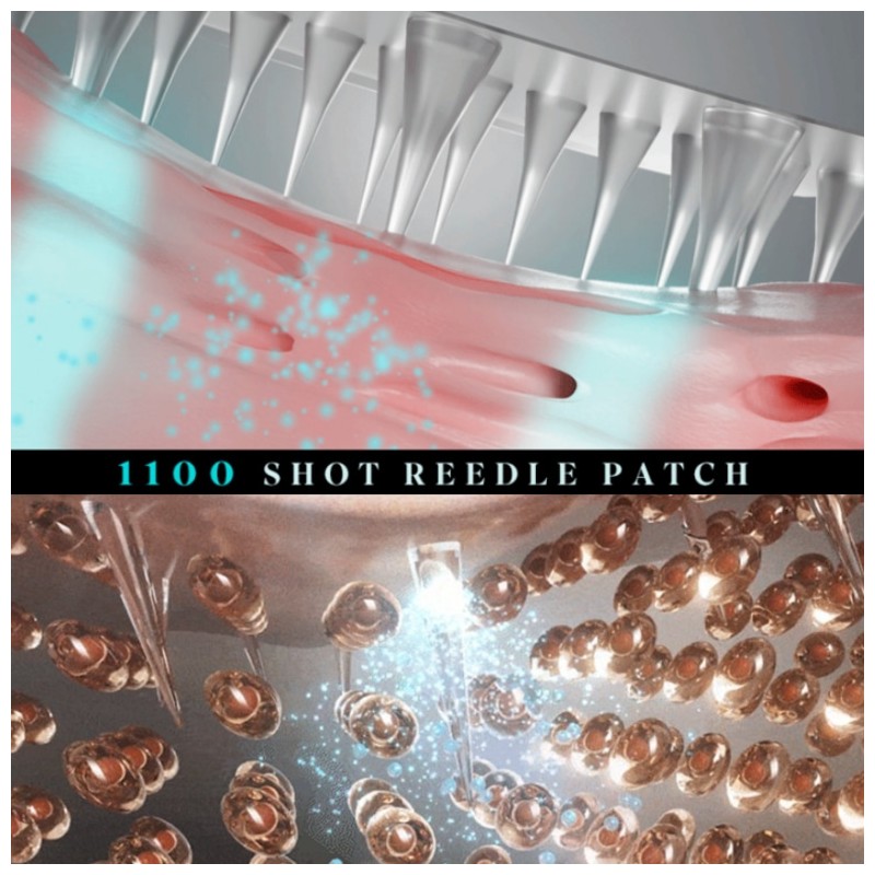 CHARD Eye Bag Lift 1100 Shot Reedle Patch 4pair