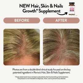 REVIVEEO Healthy Skin, Hair & Nails Supplement by Revive Essential Oils - Supports Healthy Hair with Pantented form of Biotin - Ashwagandha for Stress Support - Plus Vitamins & Minerals