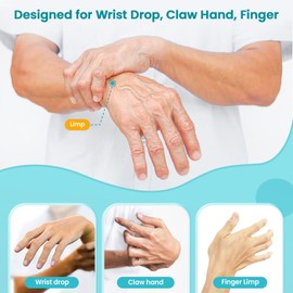 Radial Nerve Palsy Splint Brace for Wrist drop, 5 Fingers Extension, Stroke Patient Recovery, Finger Limp, Crutch Palsy, MCP Arthroplasty, for both Left and Right Hand - Gray