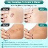 Scar Gel, Scar Cream, Advance Scar Gel for Surgical Scars,Face,Bod<wbr/>y,Leg,