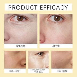 Frankincense Essential Oil, Organic Black Seed Castor & Jojoba Oils Frankincense Resin Oil for Face Moisturizer Serum.(1Pcs)