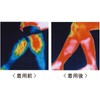 Elmo Medical Supporter, Both Shoulders, Size M
