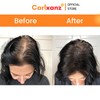 Carlxanz Hair Fiber Classic (4 x 25g)
