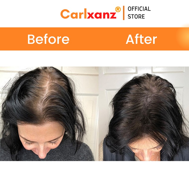 Carlxanz Hair Fiber Classic (4 x 25g)