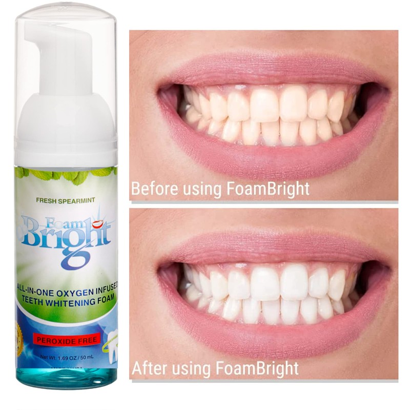 Retainer Foam Cleaner & Teeth Whitening Formula. The Ultimate Cleaning