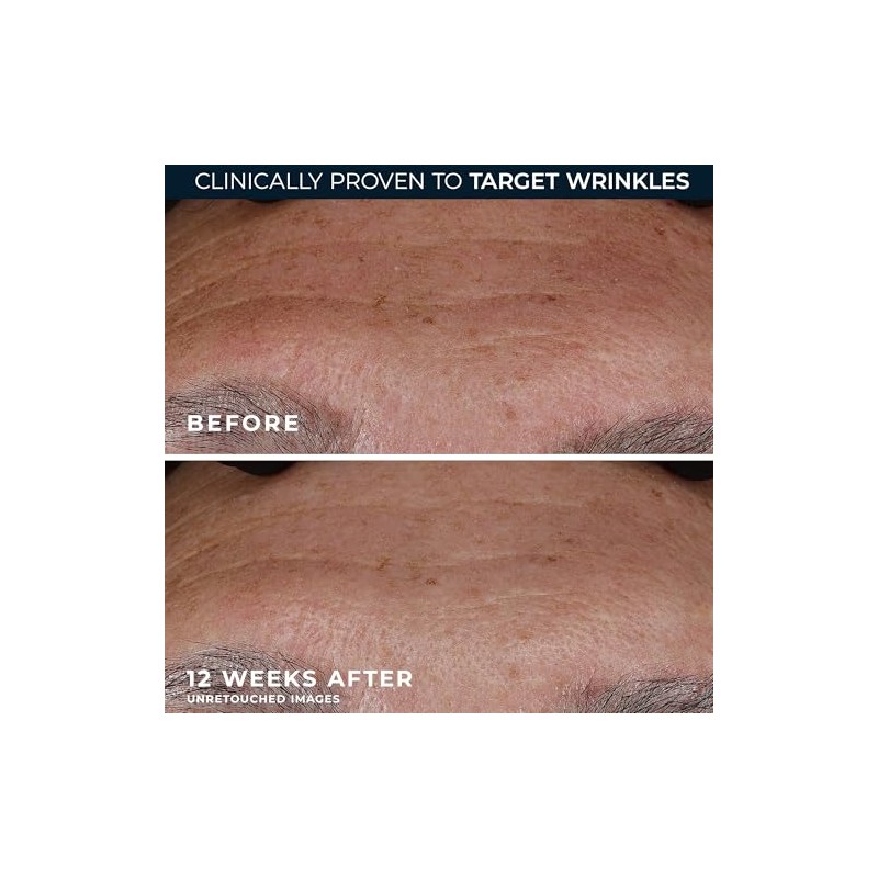 Roc Deep Wrinkle Serum Ounce