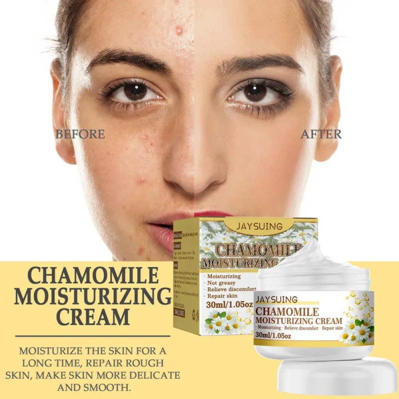 ` Crema Hidratante De Manzanilla Moisturizi Facial De .