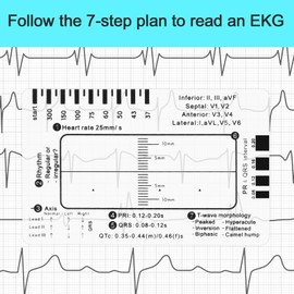ECG 7 Step Ruler, Portable ECG Assessment Tool ECG/ECG 7 Step Ruler Card for ECG/ECG Interpretation ECG Ruler Plastic Ruler Measuring Tool ECG ECG Card Ruler ECG Reference Guide with Protect Sheath