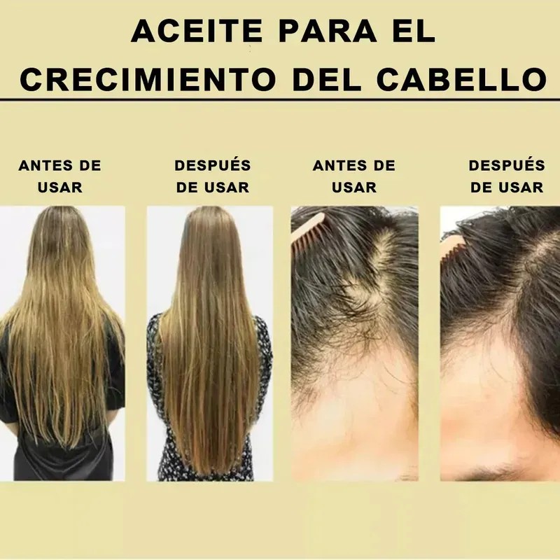5pzs 60ml Aceite Vegano Natural Para Crecimiento De Cabello