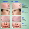 Madecassoside Toner Pads for Soothing Redness, Acne Care, Dark Spot