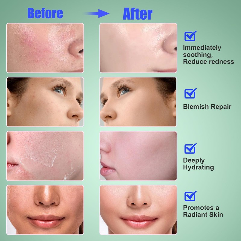 Madecassoside Toner Pads for Soothing Redness, Acne Care, Dark Spot