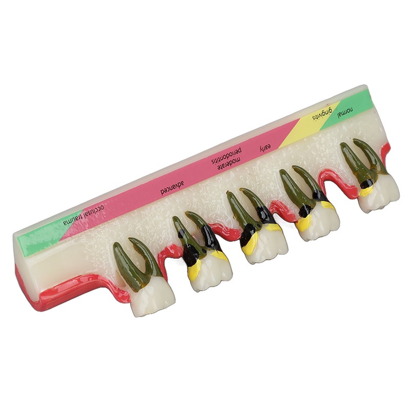 Dental Teeth Model Ceramic Clear Structure Oral Care Educational Periodontal