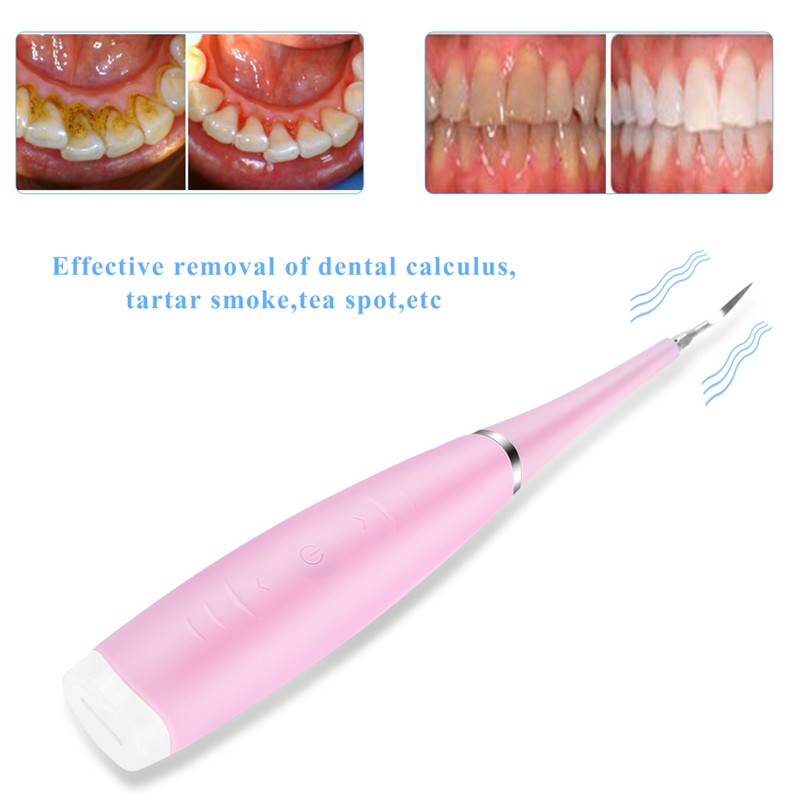 Portable Electric Calculus Plaque Removal Teeth Tartar Clean Dental Scaler