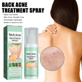 Back Acne Spray, 2% Salicylic Acid Spray for Back and Body, Tea Tree Oil Back Acne Spot Treatment Solution for Men and Women