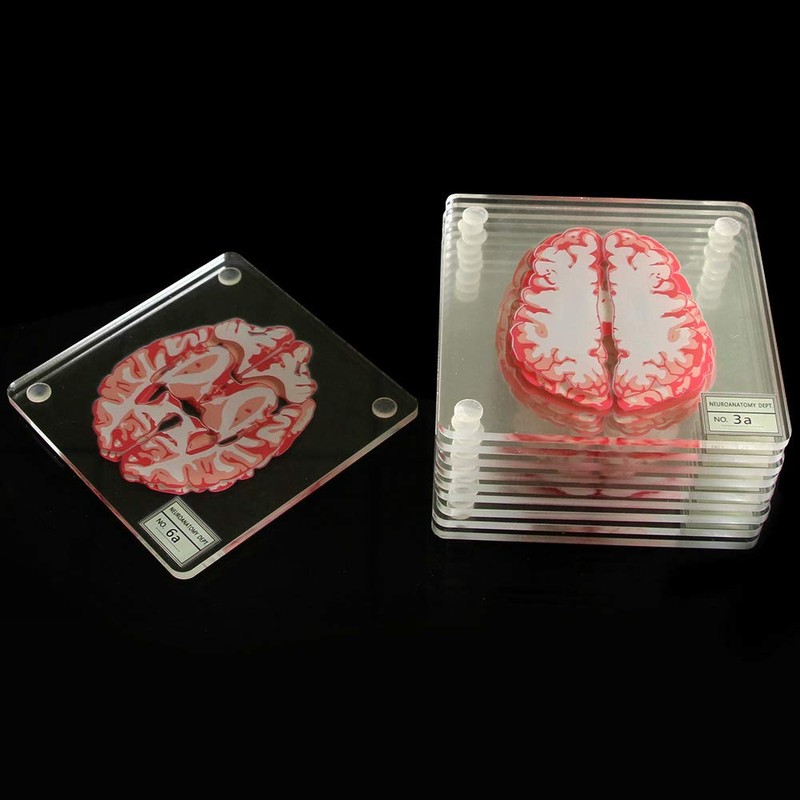 Timethink (Set of 10) 4'' 3D Brain Specimen Coasters, Funny