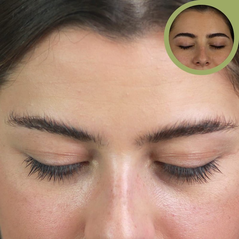 Natucain Eyelash Serum I Lash Serum for Longer Eyelashes I