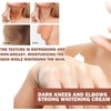 Joint Darkening Cream,Whitening Cream,Knuckle Brightening Cream,Brightening Cream,Body Whitening Cream,Skin Brightener