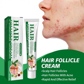 Acne Cream for Face and Scalp One Size / One Color