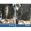 Pantogar (Pantovigar) Specific Treatment for Hair and Nails - 90
