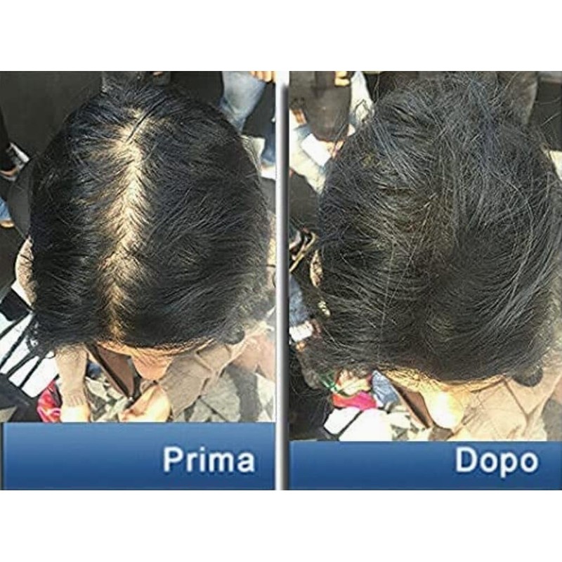 Pantogar (Pantovigar) Specific Treatment for Hair and Nails - 90