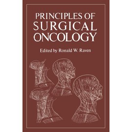 Principles of Surgical Oncology