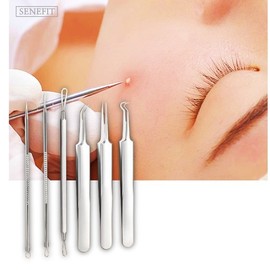 Pimple squeezing, back acne extraction, cheek blackheads, chin whiteheads / 뾰루지짜기 등드름압출 볼블랙헤드 턱화이트헤드