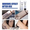 Generic Generic Removal Fast And Effective Removal Removal Skin Pigment