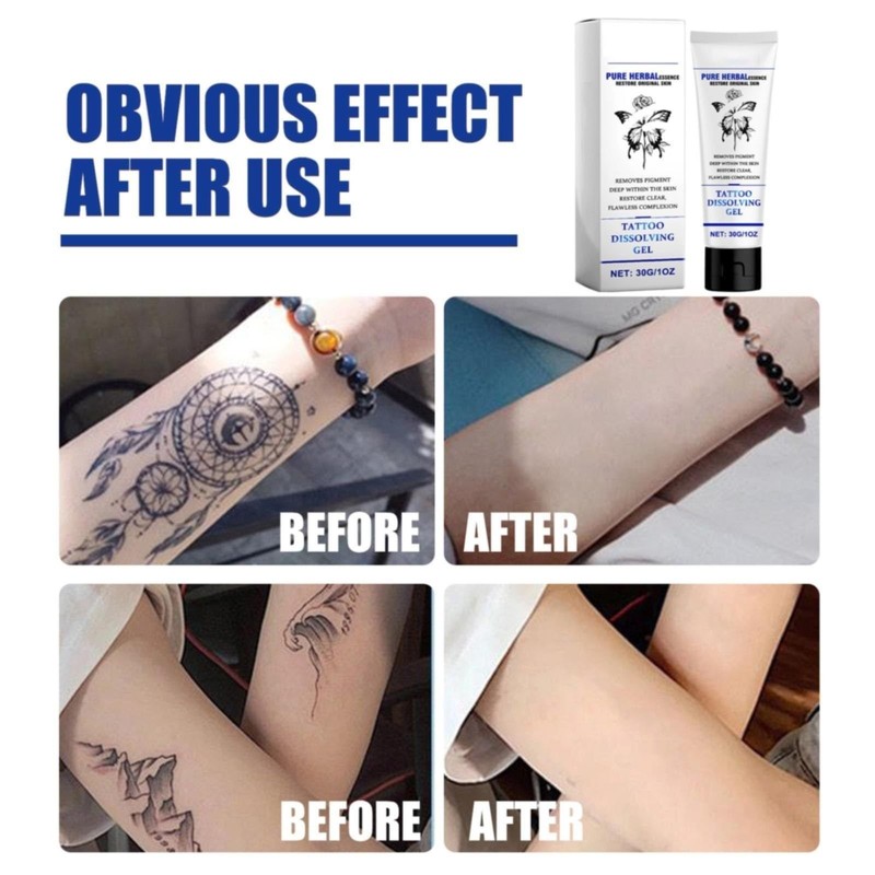 Generic Generic Removal Fast And Effective Removal Removal Skin Pigment