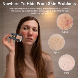 JBMBHC Handheld Dermatoscope Skin Analyzer Machine, Wireless Portable Digital Microscope with 1080P IPS Screen 8 LEDs, 500X Magnifier, for Scalp/Hair Trichomes Facial Skin Dermatoscope