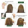 Kit Tratamiento Para El Cabello Aceite De Romero Y Fijadores