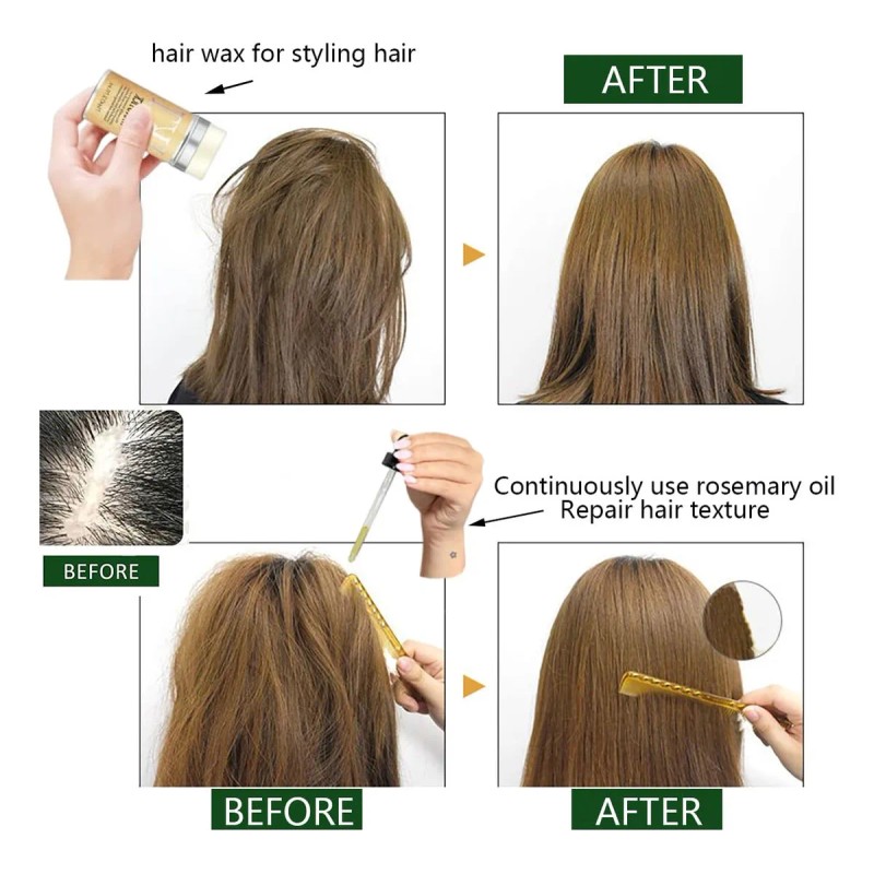 Kit Tratamiento Para El Cabello Aceite De Romero Y Fijadores