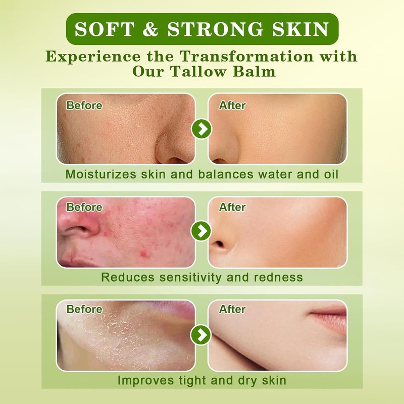 Beef Tallow for Skin Care