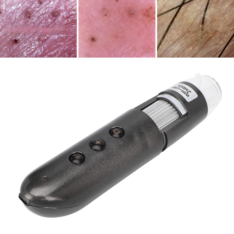 200X Magnification Skin Hair Scalp Detector 2MP Wifi USB High