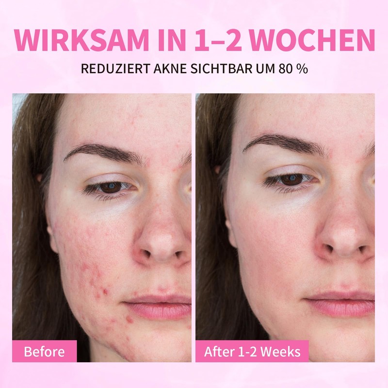 LXSKN 6 Piece Skincare Set