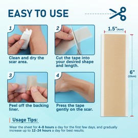 MEDLOT MEDLOT Silicone Scar Sheets, 10pcs, Silicone Tape for Scar Treatment, Reusable Scar Strips for Surgical, C-Section, Keloid Bump, Stretch Marks, Burn, Acne Scar Removal, Each 1.5” x 6”