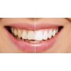 Whitening Pasta De Dientes Blanqueadora Brillante Farmasi