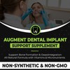 Augment Nutrition Dental Implant Support Supplement - Support Bone Formation