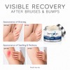Vitamin K Cream- Moisturizing Bruise Healing Formula. Dark Spot Corrector