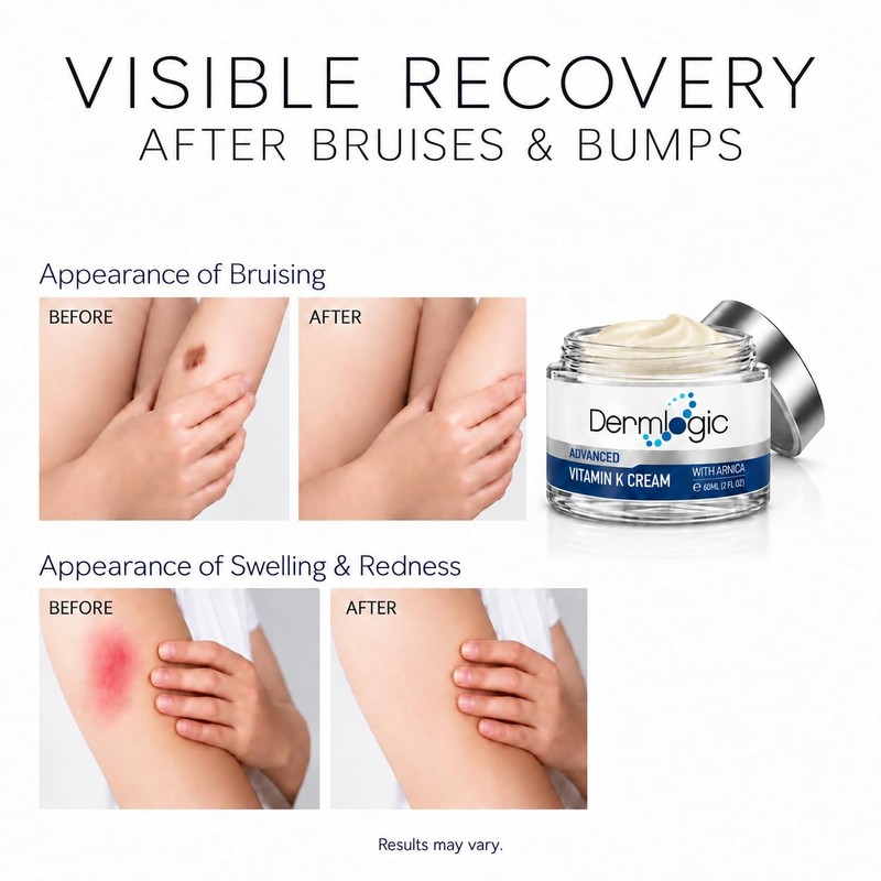 Vitamin K Cream- Moisturizing Bruise Healing Formula. Dark Spot Corrector