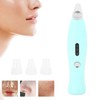 Electric Blackhead Removal Suction Instrument Portable Household Facial Pores Acnes