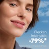 NIVEA Cellular Luminous 630 Verbesserungsserum für Akne-Farbversion, 30 ml