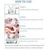 Adjustable Smile Supports - 2 Pairs (Top & Bottom) |