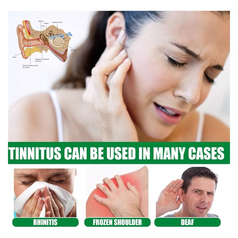 generic 6×aceite Para Aliviar Los Zumbidos En Los Oídos, Gotas