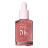 Serum Anua Peach 70 Niacin 30ml Viral Corea + Mini