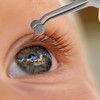 iplusmile Meibom Stainless Steel Tweezers Eyelid Massage Tweezers Microscope Ophthalmic