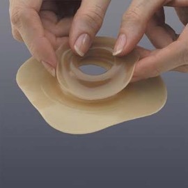 Unknown Hollister 79540 Skin Barrier Rings Adapt Convex (40mm) 1-9/16"