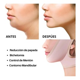 Mentonera Para Cirugias O Reducir Marca Kisha