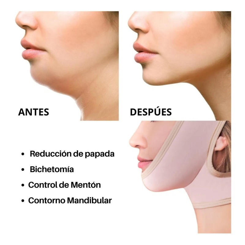 Mentonera Para Cirugias O Reducir Marca Kisha