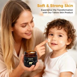 Whipped Grass-Fed Beef Tallow Honey Balm 4oz, All-Natural Moisturizing Cream with Lavender for Soft, Smooth, Hydrated Skin, Body Care & Dry Skin Relief