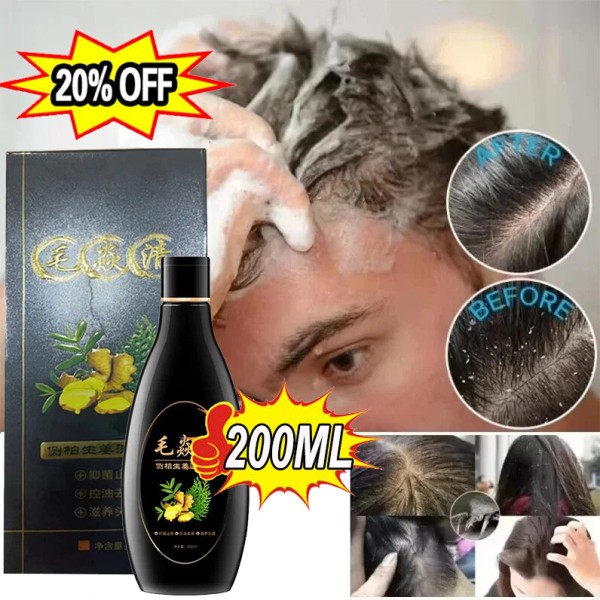 Unbranded 2025 Scalp Hair Follicle Shampoo Antibacterial Anti-Itching Mites Oil